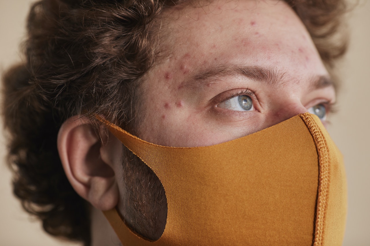 The Common Reasons Men Get Acne